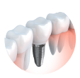 Endodontics Oral Surgery Implants